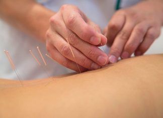 Medicina Tradicional China: El equilibrio de la energía, clave para la salud acupuntura