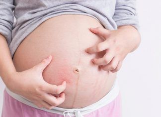 La Homeopatía en el Embarazo, Parto y Puerperio homeopatía en embarazo