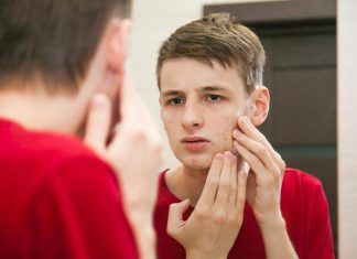 Acné: una pesadilla en la adolescencia acne adolescencia