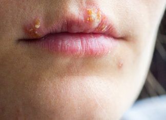 Tratamientos antivirales, ¿qué son y cuándo se utilizan? tratamientos antivirales