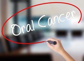Primeros síntomas del cáncer oral cáncer oral