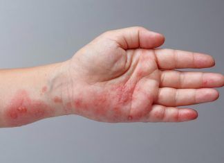 El Biomagnetismo y su conexión con la acupuntura biomagnetismo