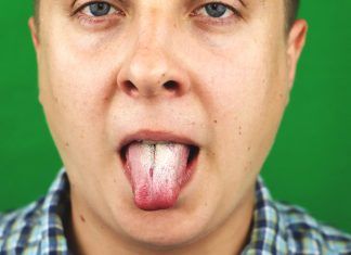 Tratamiento de Candida albicans, ¿también con plantas medicinales? Candida