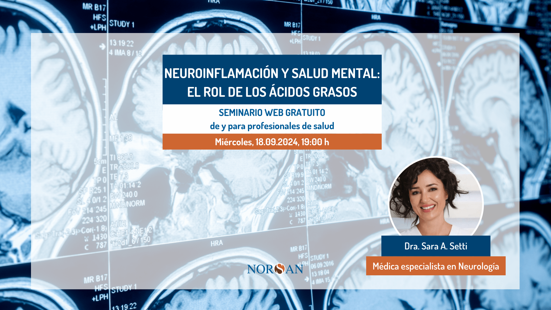 neuroinflamación