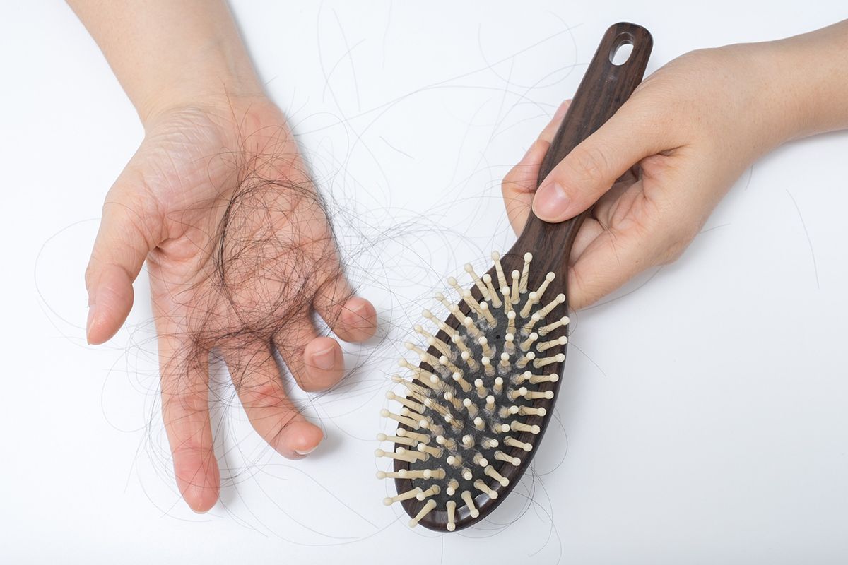caída del pelo