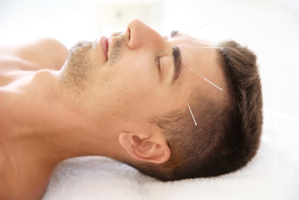 Acupuntura
