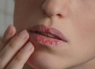 Comparando bálsamos labiales bálsamos labiales