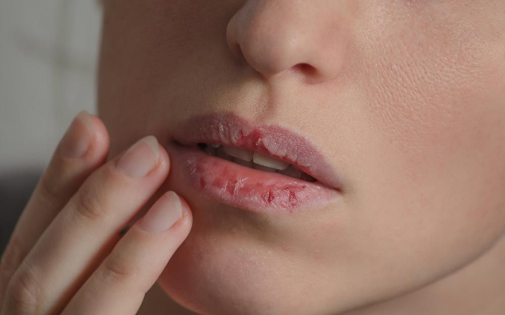 bálsamos labiales