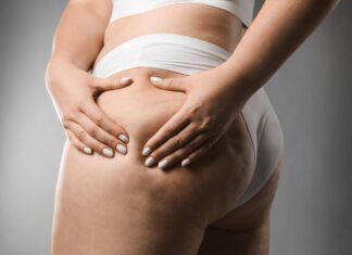 Celulitis bajo control: los aceites esenciales más efectivos celulitis