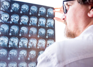 Tengo un tumor hipofisario: ¿debo operarme? doctors