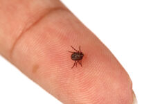 Garrapatas: cómo prevenir y actuar ante una picadura garrapatas Tick crawling on human skin