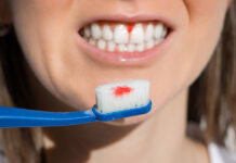 Omega-3 y periodontitis: la importancia de resolver la inflamación, ¿te sangran las encías al cepillarte los dientes? encías sangre