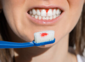 Omega-3 y periodontitis: la importancia de resolver la inflamación, ¿te sangran las encías al cepillarte los dientes? encías sangre