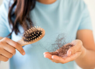 La esperanza natural de la “alopecia estacional” Caída de pelo
