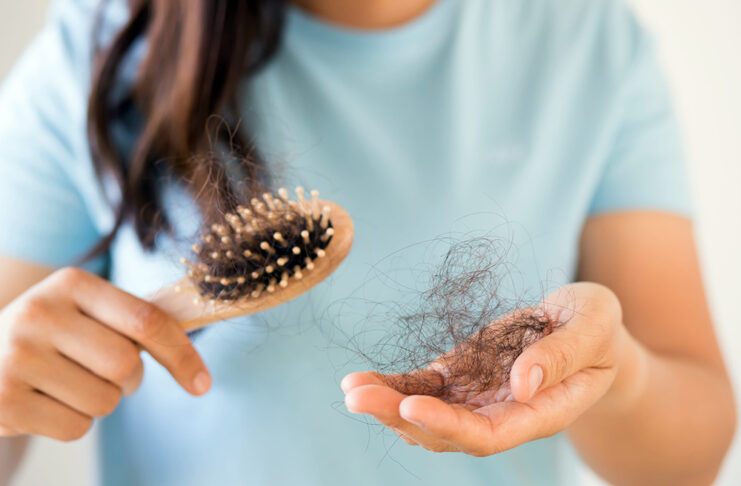 La esperanza natural de la “alopecia estacional” Caída de pelo