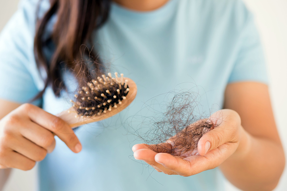 Caída de pelo